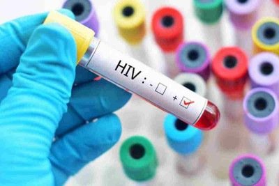HIV -  (crédito: PRess Serbia - Flickr)