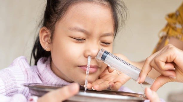 A lavagem nasal em crian&ccedil;as &eacute; um m&eacute;todo eficaz para aliviar congest&atilde;o, desde que realizada com os devidos cuidados. -  (crédito: iStock )