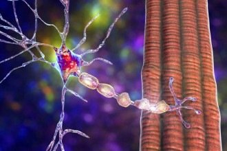 Cientistas holandeses descobrem como células de defesa do cérebro podem acabar agravando a esclerose múltipla