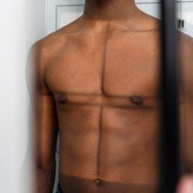 Mastectomia tem devolvido autoestima e qualidade de vida a homens trans - FreePik/Magnific