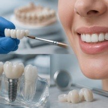 Diabetes pode afetar implantes dentários? Veja sinais de alerta na gengiva - imagem i.a 