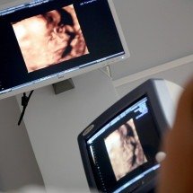 Pesquisa reforça técnica fetal para hérnia diafragmática - DINO