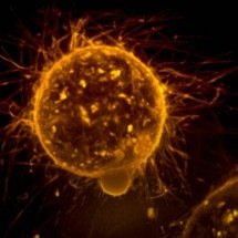 Cientistas descobrem possível forma de desativar progressão do câncer - NCI/Unsplash