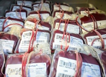 Cen&aacute;rio pode causar remarca&ccedil;&atilde;o de cirurgias eletivas e coloca em risco grandes traumas em hospitais de urg&ecirc;ncia. -  (crédito: Leandro Couri/EM/DA Press)