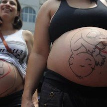 Fatores sociais e estruturais empurram mulheres para cesarianas - Agencia Brasil/Tânia Rêgo