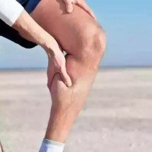 Negligência masculina: varizes não cuidadas podem virar feridas e tromboses -  Arquivo pessoal