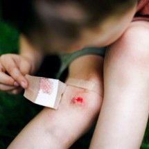 Mercurocromo: o remédio tóxico que quase todo mundo usava para machucados de crianças - Acervo: Farmacêuticos das Antigas