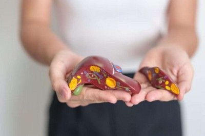 Hepatites B e C podem evoluir silenciosamente durante anos, aumentando o risco de cirrose e câncer do fígado -  (crédito: Magnific)