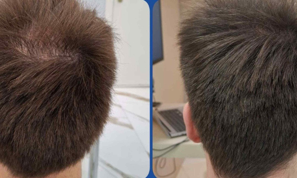 A tricologia se consolida como uma aliada importante não apenas na estética, mas também na promoção de saúde, bem-estar e qualidade de vida - (crédito: Arquivo Pessoal)