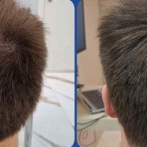 Tricologia reflete aumento da busca por cuidado com cabelo e couro cabeludo - Arquivo Pessoal