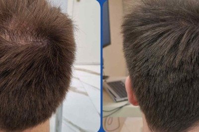 A tricologia se consolida como uma aliada importante não apenas na estética, mas também na promoção de saúde, bem-estar e qualidade de vida -  (crédito: Arquivo Pessoal)