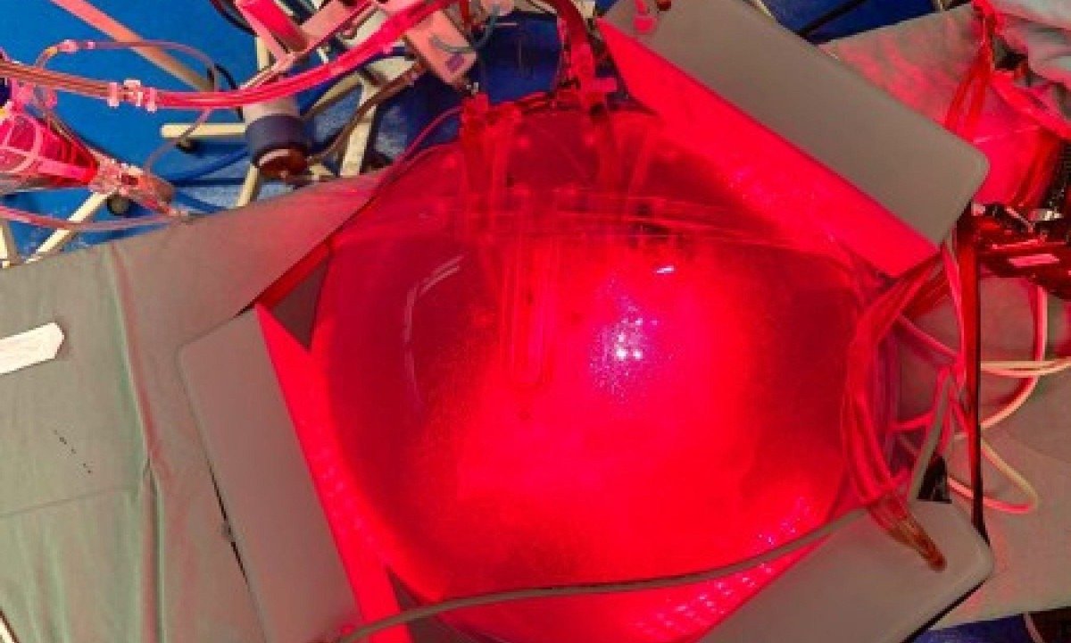 Terapia baseada em luz aplicada em pulmão para transplante; no tratamento de pneumonia, o mesmo tipo de fonte emissora de luz pode ser utilizado - (crédito: Cristina Kurachi)