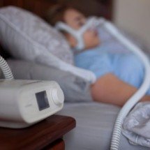 Pacientes com hipotireoidismo apresentam apneia do sono com mais frequência - Shutterstock/Fapesp/Divulgção