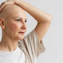 Por que o cabelo cai durante o tratamento oncológico? - Magnific