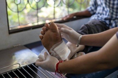 Os tratamentos disponíveis atualmente nem sempre conseguem eliminar os fatores que mantêm a ferida aberta -  (crédito: Shutterstock/Fapesp/Reprodução)