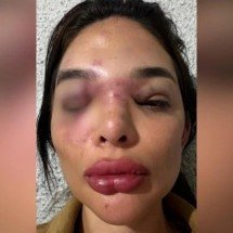Empresário é preso por suspeita de agredir mulher com taco de beisebol em SP