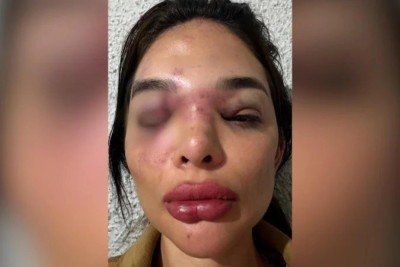 Vítima violência doméstica  -  (crédito: Reprodução/Redes Sociais)