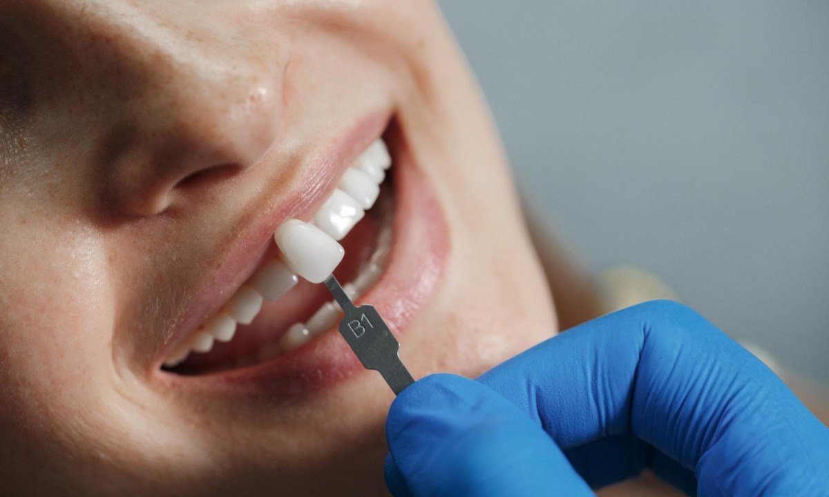 Falha em tratamento dentário nem sempre indica erro - (crédito: DINO)