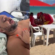 Morador do DF perde os movimentos após acidente em praia de Pernambuco - Material cedido ao Correio