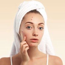 Danos na pele e acne: perigo de usar cosméticos por influência da internet - Magnific