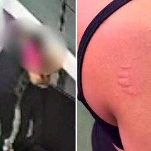 Mulher denuncia assédio após ser mordida por instrutor em academia