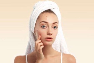 Danos na pele e acne: perigo de usar cosméticos por influência da internet