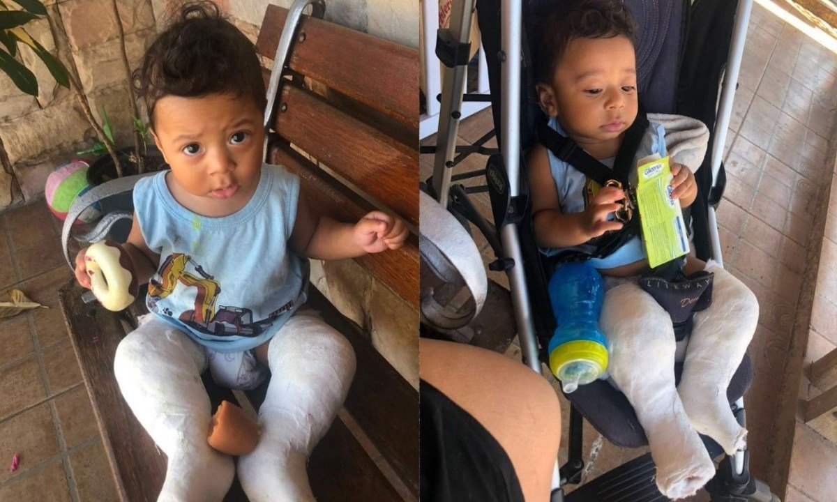 Ravi Luiz Vitorino Gonzaga foi diagnosticado com pé torto congênito poucas horas depois de nascer - (crédito: Raquel Vitorino)