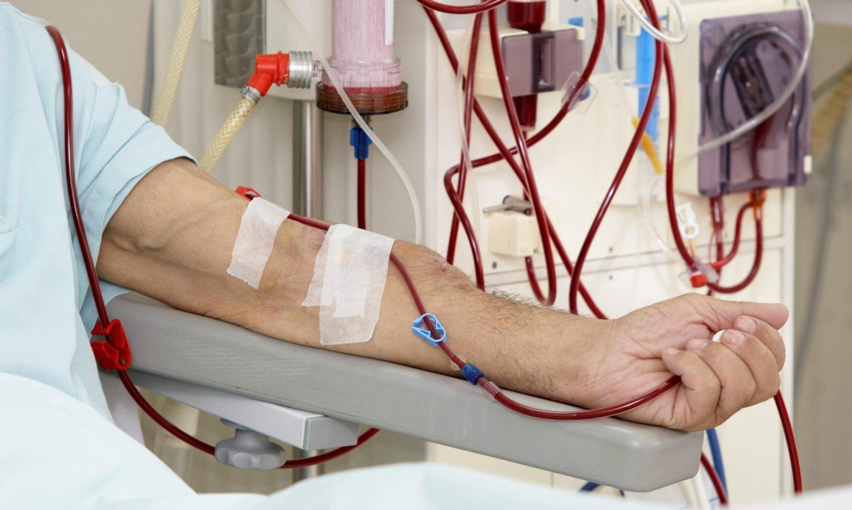 patient monitored by electronic sphygmomanometer during dialysis session
- (crédito: Getty Images)