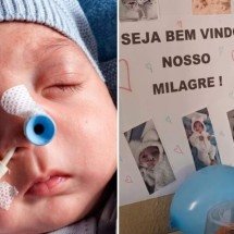 Recém-nascido sobrevive após ser colocado em saco funerário e família comemora "milagre" - Tupi