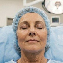 Mais que rejuvenescer, blefaroplastia restaura a amplitude da visão - IA/Gemini