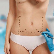 Menos inchaço, mais conforto: vantagens de fazer cirurgia plástica no frio - Magnific