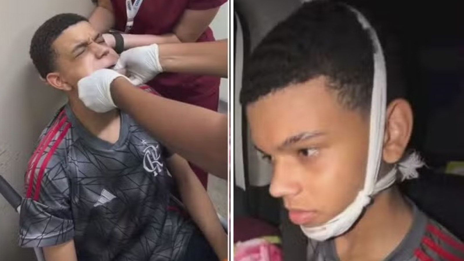 Felipe Santos Firmino recebe atendimento m&eacute;dico e se recupera ap&oacute;s a mand&iacute;bula 'cair' durante um bocejo -  (crédito: Redes sociais / divulga&ccedil;&atilde;o)