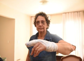  Na foto, Elvia Marques, 58 anos, artesa, moradora do condominio, conta que foi agredida pela o casal -  (crédito: Gladyston Rodrigues/EM/D.A. Press. Brasil. Belo Horizonte. MG.)