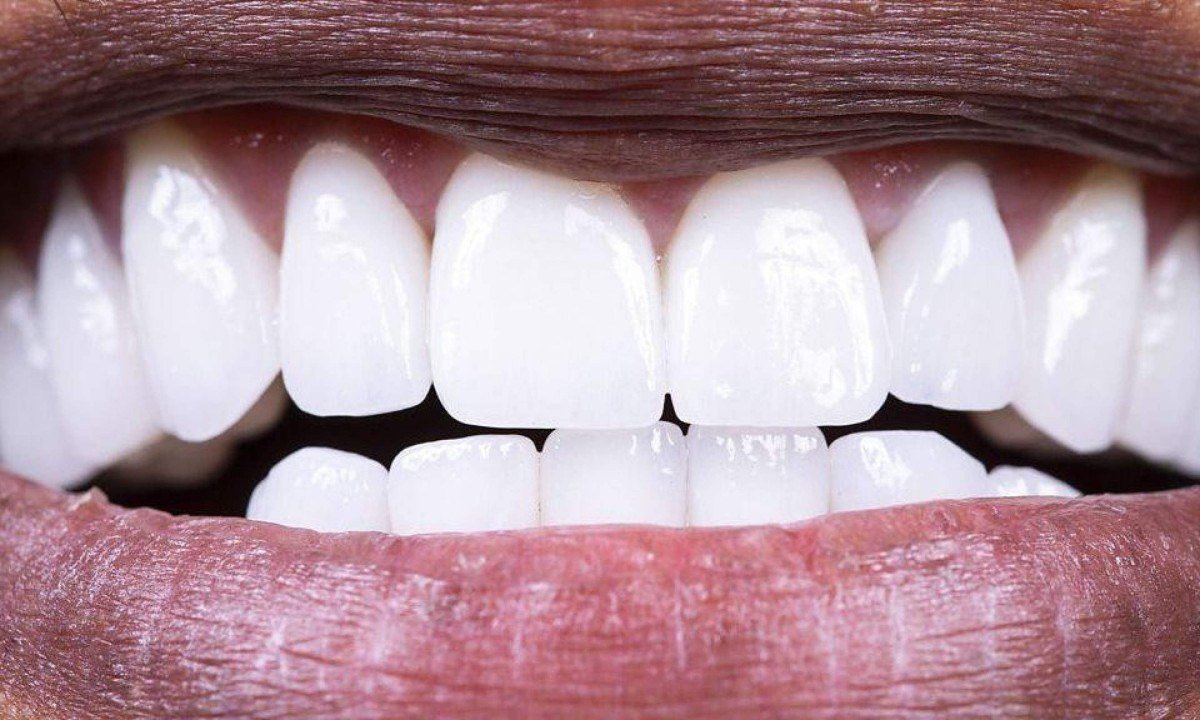 Verduras como a couve kale podem nos ajudar a manter uma microbiota oral saudável - (crédito: Getty Images)