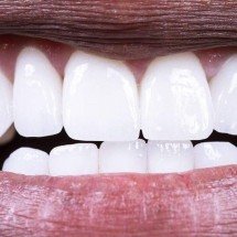 Como proteger as boas bactérias da sua boca