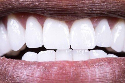 Verduras como a couve kale podem nos ajudar a manter uma microbiota oral saudável -  (crédito: Getty Images)