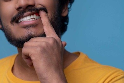 Gengiva que sangra indica, geralmente, uma inflama&ccedil;&atilde;o  -  (crédito: Magnific )