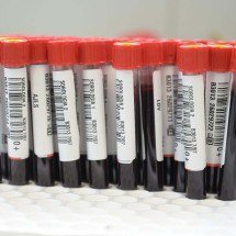 Seis tipos de sangue estão em nível crítico ou de alerta em Minas - Leandro Couri/EM/D.A.Press