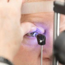 Retinopatia diabética: entenda condição ocular causada pelo diabetes -  CBO/Divulgação