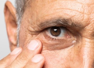 Estudo epidemiológico no Brasil aponta que 92,2% eram melanomas cutâneos; 5,7%, oculares e 2,5%, de mucosa -  (crédito: magnific)