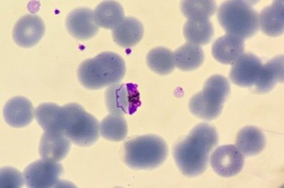Estágio de formação de gametócitos Plasmodium falciparum  -  (crédito:  Shutterstock)