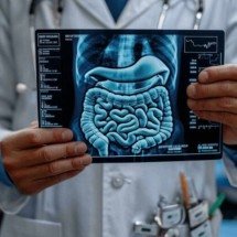 Congresso de coloproctologia discute imunoterapia, IA e novas terapias  - Magnific