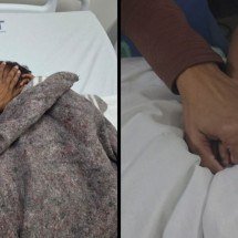 Criança de 3 anos é atacada por pitbull e passa por cirurgia 