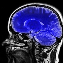 O segredo biológico dos introvertidos que explica por que mentes quietas processam informações de maneira tão diferente da maioria das outras pessoas - - Dominio Publico/hippopx.com