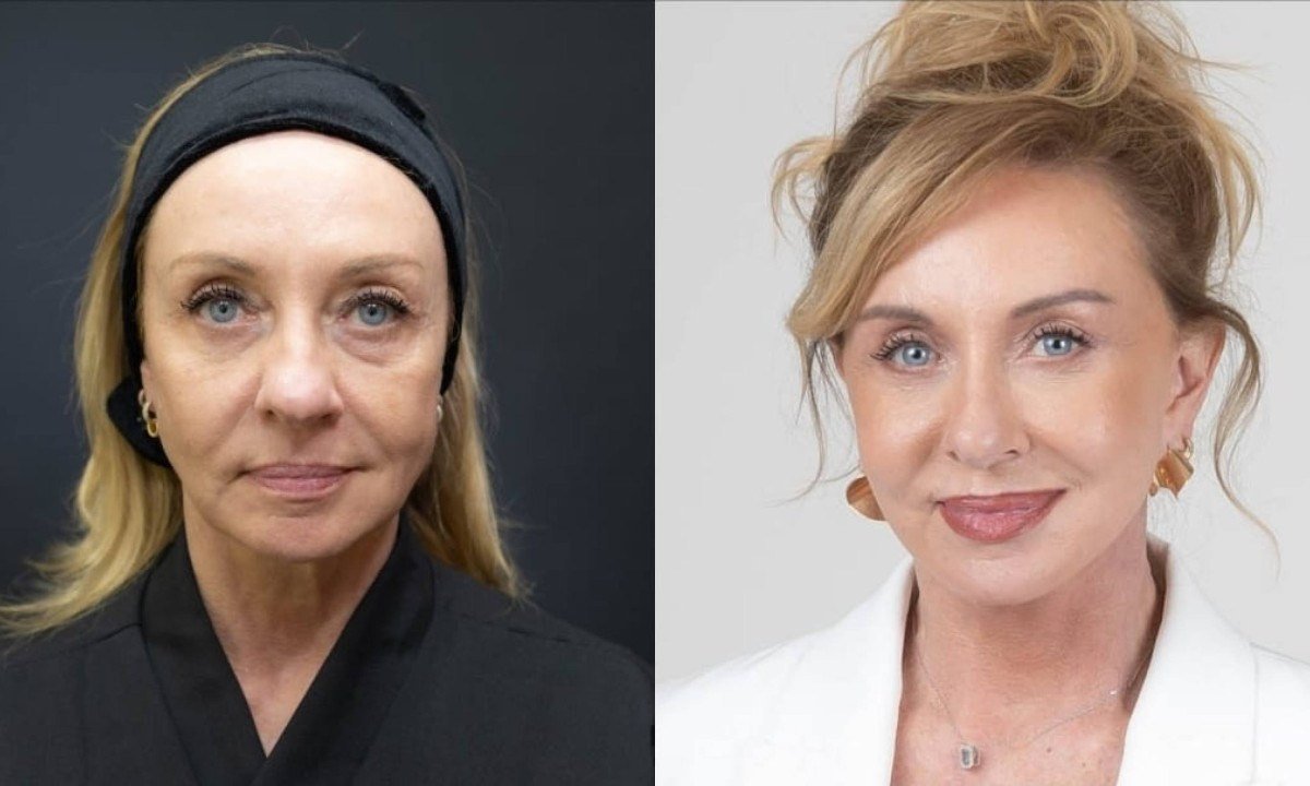 “Bem-vindos ao luxo”: facelift reforça imagem de corretora de alto padrão - (crédito: PulseBrand)