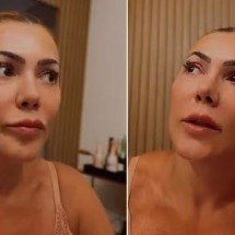 Ex-BBB Fabiana Teixeira conta detalhes de diagnóstico de cisto no cérebro: "Entrei em pânico"