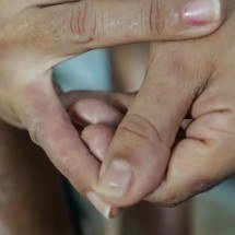 Dermatite atópica impacta pele, sono e autoestima: saiba como tratar -  Rafa Neddermeyer/Agência Brasil