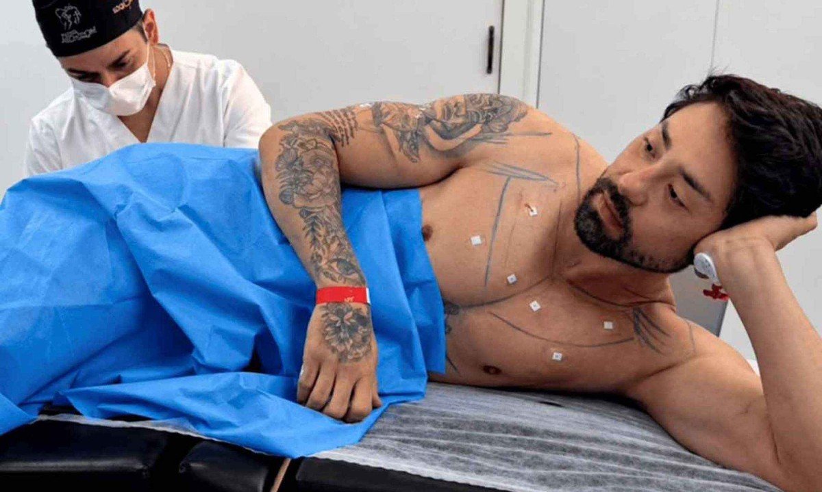 Rico Melquíades durante procedimento realizado pelo médico Chris Lima -  (crédito: @dr.chrisbacelarlima/Divulgação (emc61700))