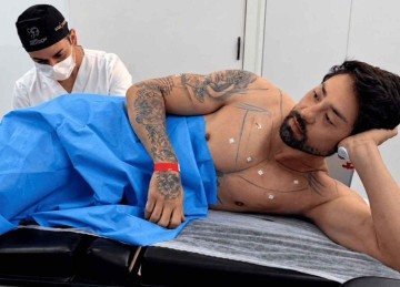 Rico Melquíades durante procedimento realizado pelo médico Chris Lima -  (crédito: @dr.chrisbacelarlima/Divulgação (emc61700))