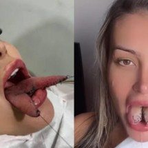 Bifurcação na língua: riscos e alertas de Andressa Urach após arrependimento - Tupi